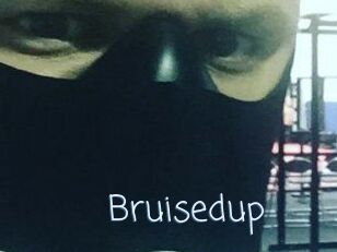 Bruisedup